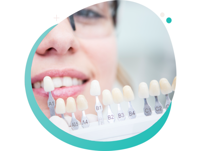 https://dentistefrancais.com/wp-content/uploads/2023/02/French-dental-practise-15-640x480.png